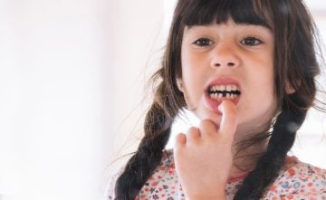 child with a missing tooth
