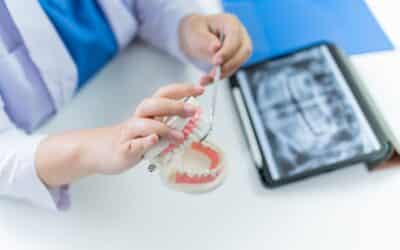 How Much Does It Cost To Fix A Cracked Tooth?
