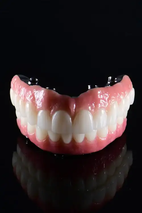 all-on-4-plus-brighton All on 4 Plus full-arch implant treatment at Lifestyle Smiles, Bayside, Melbourne