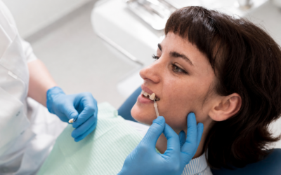 Best Treatment Options for a Chipped Tooth